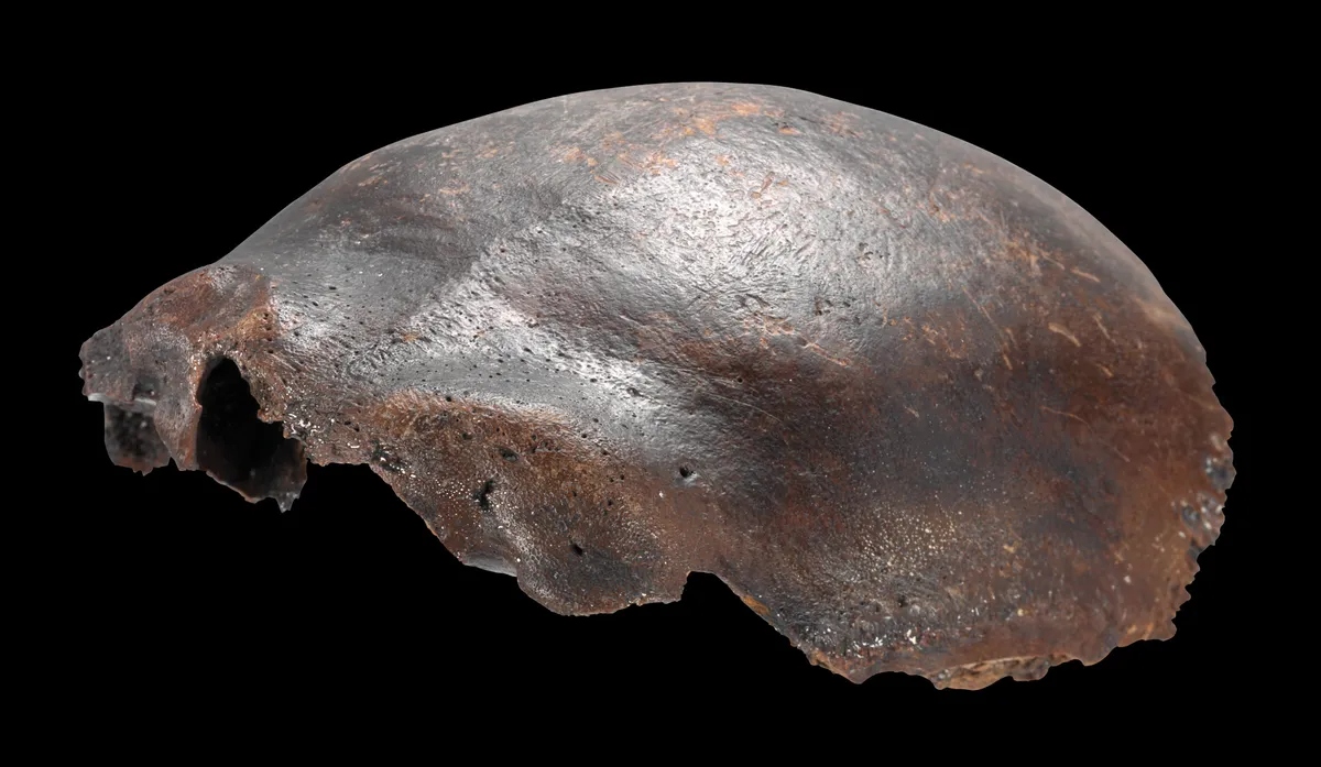 human-skull-bone-from-hahnofersa-1777347566077-17773475665131606637936